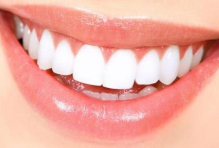 Sonhar com dente